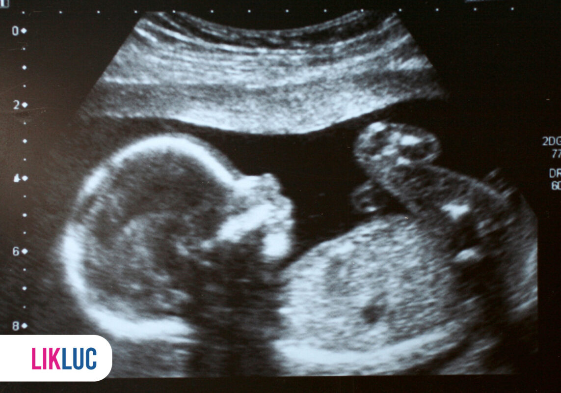 Ultrassom de bebê em desenvolvimento