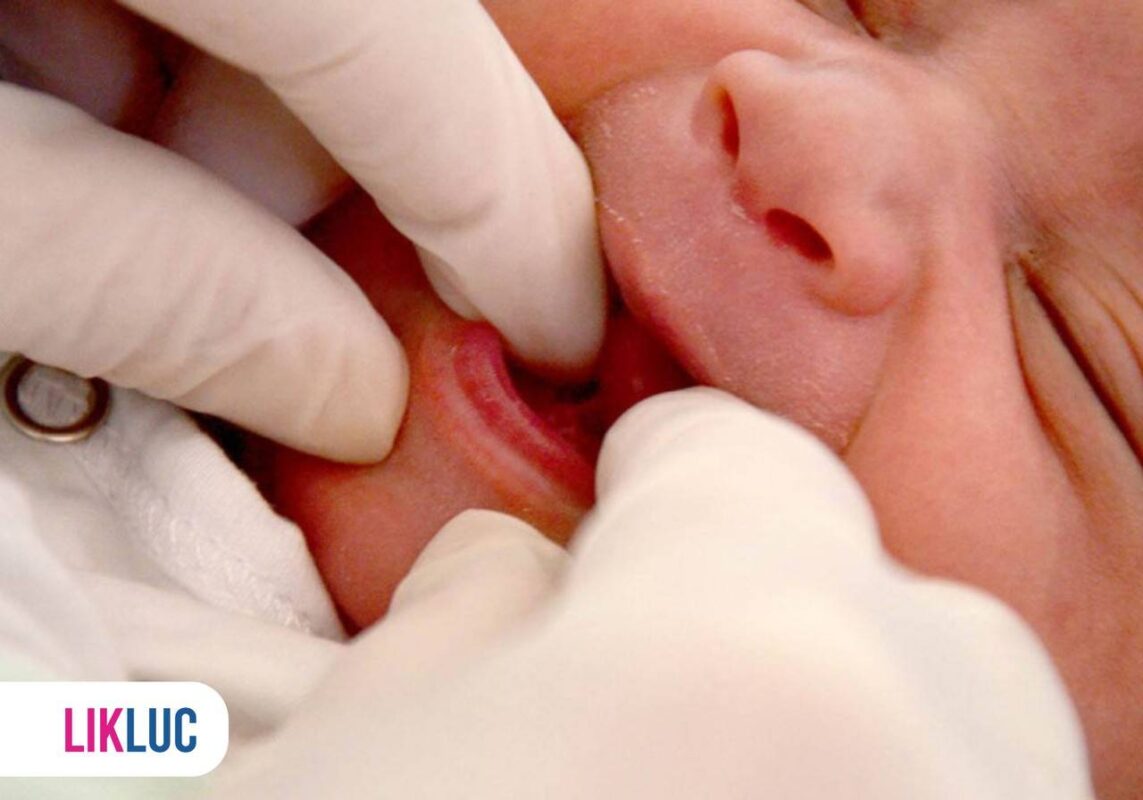 Pessoa utilizando luvas e analisando boca de bebê