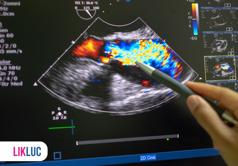Ultrassom mostrando imagem vascular colorida